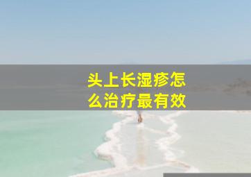 头上长湿疹怎么治疗最有效