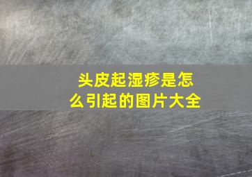 头皮起湿疹是怎么引起的图片大全