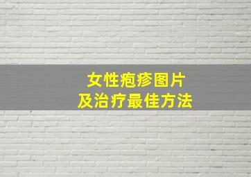 女性疱疹图片及治疗最佳方法