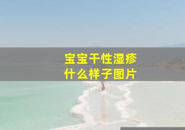 宝宝干性湿疹什么样子图片