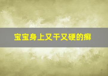 宝宝身上又干又硬的癣