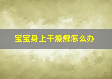 宝宝身上干燥癣怎么办