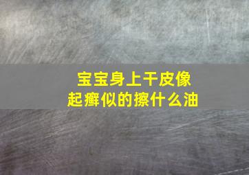 宝宝身上干皮像起癣似的擦什么油