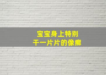 宝宝身上特别干一片片的像癣