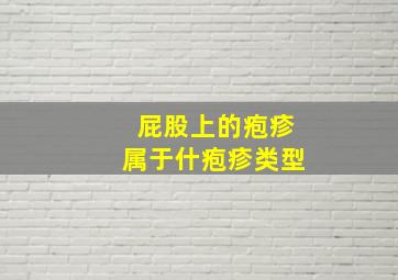 屁股上的疱疹属于什疱疹类型