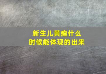 新生儿黄疸什么时候能体现的出来