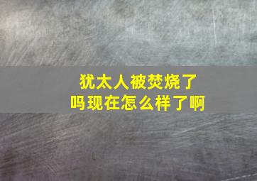 犹太人被焚烧了吗现在怎么样了啊