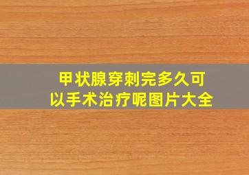 甲状腺穿刺完多久可以手术治疗呢图片大全