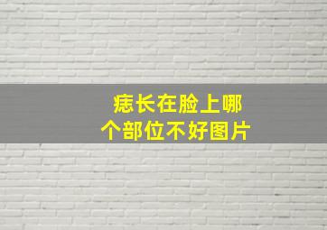 痣长在脸上哪个部位不好图片