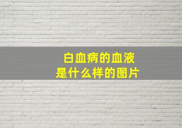 白血病的血液是什么样的图片