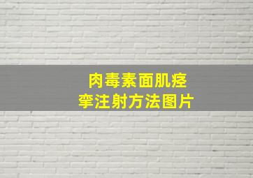 肉毒素面肌痉挛注射方法图片