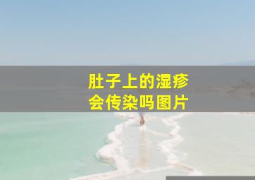 肚子上的湿疹会传染吗图片