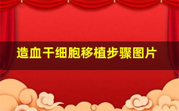 造血干细胞移植步骤图片