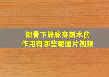 锁骨下静脉穿刺术的作用有哪些呢图片视频